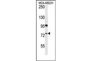 Western blot analysis of HFM1 Antibody (C-term) in MDA-MB231 cell line lysates (35ug/lane). (HFM1 anticorps  (C-Term))
