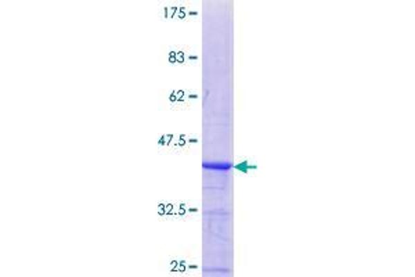 CA10 Protein (AA 229-328) (GST tag)