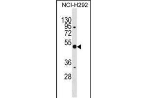 Western blot analysis in NCI-H292 cell line lysates (35ug/lane). (Annexin a10 anticorps  (C-Term))