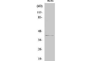 Western Blotting (WB) image for anti-Chloride Channel, Nucleotide-Sensitive, 1A (CLNS1A) (C-Term) antibody (ABIN3176888) (CLNS1A anticorps  (C-Term))