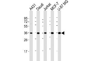 Western Blotting (WB) image for anti-MHC Class I Polypeptide-Related Sequence A (MICA) (AA 68-97) antibody (ABIN652566)