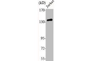 Western Blot analysis of Jurkat cells using N-cadherin Polyclonal Antibody (N-Cadherin anticorps  (C-Term))