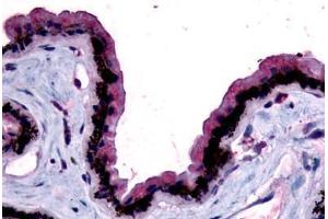 Human Eye, Retina (formalin-fixed, paraffin-embedded) stained with MTNR1B antibody ABIN213602 at 10 ug/ml followed by biotinylated goat anti-rabbit IgG secondary antibody ABIN481713, alkaline phosphatase-streptavidin and chromogen. (Melatonin Receptor 1B anticorps  (N-Term))