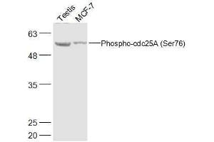 Lane 1: Mouse Testis lysates Lane 2: Human MCF-7 lysates probed with Phospho-cdc25A (Ser76) Polyclonal Antibody, Unconjugated  at 1:500 dilution and 4˚C overnight incubation. (CDC25A anticorps  (pSer76))