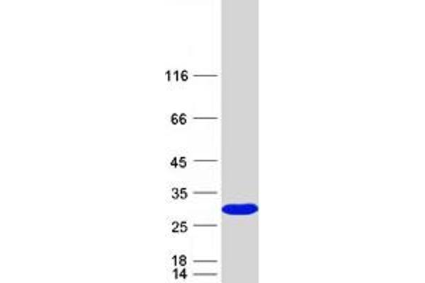 SSSCA1 Protein (Myc-DYKDDDDK Tag)