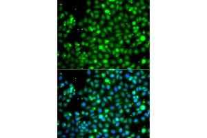 Immunofluorescence analysis of A549 cells using NME2 antibody. (NME2 anticorps  (AA 1-152))