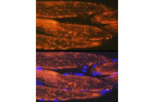 Immunofluorescence analysis of rat bone marrow cells using  Rabbit mAb (ABIN7265398) at dilution of 1:100 (40x lens). (ACTN3 anticorps)