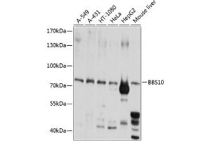 Western blot analysis of extracts of various cell lines, using BBS10 antibody  at 1:1000 dilution. (BBS10 anticorps  (AA 474-723))