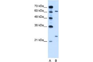WB Suggested Anti-RORA Antibody Titration:  0. (RORA anticorps  (Middle Region))