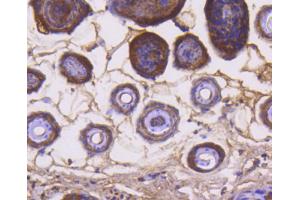 Paraformaldehyde-fixed, paraffin embedded mouse skin, Antigen retrieval by boiling in sodium citrate buffer (pH6) for 15min, Block endogenous peroxidase by 3% hydrogen peroxide for 30 minutes, Blocking buffer at 37°C for 20min, Antibody incubation with Cytochrome C (1F10) Monoclonal Antibody  at 1:50 overnight at 4°C, followed by a conjugated secondary and DAB staining. (Cytochrome C anticorps)