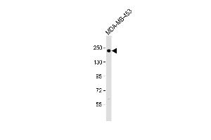 Anti ERBB2 Antibody  at 1:500 dilution + MDA-MB-453 whole cell lysate Lysates/proteins at 20 μg per lane. (ErbB2/Her2 anticorps  (AA 706-735))