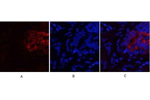 Immunofluorescence analysis of human lung tissue. (PI3K p85 alpha/gamma anticorps)