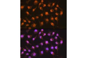 Immunofluorescence analysis of HeLa cells using PER2 Rabbit mAb (ABIN7269224) at dilution of 1:100 (40x lens). (PER2 anticorps)