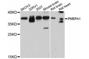 Western blot analysis of extracts of various cell lines, using PMEPA1 antibody. (PMEPA1 anticorps)