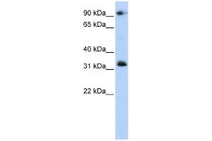 CCDC69 antibody used at 1 ug/ml to detect target protein. (CCDC69 anticorps  (Middle Region))