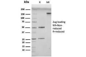 SDS-PAGE Analysis Purified N-Cadherin Mouse Monoclonal Antibody (13A9). (N-Cadherin anticorps  (Cytoplasmic Domain))