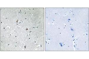 Immunohistochemistry (IHC) image for anti-Mechanistic Target of Rapamycin (serine/threonine Kinase) (mTOR) (pSer2448) antibody (ABIN2888475) (MTOR anticorps  (pSer2448))