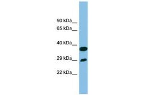 RTP4 anticorps  (AA 107-156)