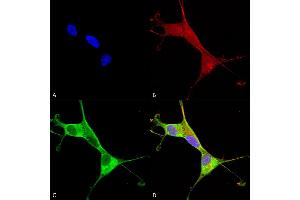 Immunocytochemistry/Immunofluorescence analysis using Mouse Anti-Copper Transporting ATPase 1 Monoclonal Antibody, Clone S60-4 (ABIN2485192). (ATP7A anticorps  (AA 42-61) (FITC))