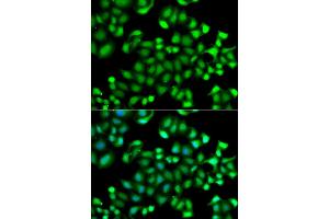 Immunofluorescence analysis of A549 cells using MAPKAPK3 antibody. (MAPKAP Kinase 3 anticorps)