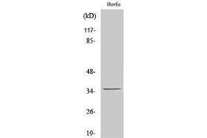 Western Blotting (WB) image for anti-Nanog Homeobox Pseudogene 8 (NANOGP8) (Internal Region) antibody (ABIN6283085) (NANOGP8 anticorps  (Internal Region))