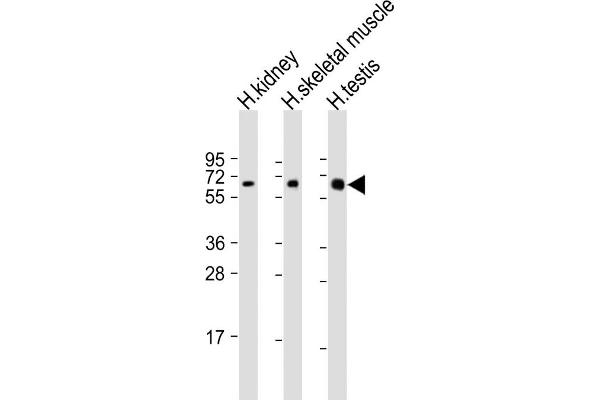 DMRT2 anticorps  (AA 357-392)