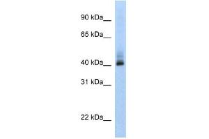 ANKRD42 antibody used at 1 ug/ml to detect target protein. (ANKRD42 anticorps  (N-Term))