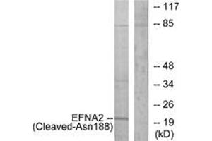 Western Blotting (WB) image for anti-Ephrin A2 (EFNA2) (AA 139-188), (Cleaved-Asn188) antibody (ABIN2891194) (Ephrin A2 anticorps  (Cleaved-Asn188))