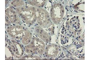 Immunohistochemical staining of paraffin-embedded Human Kidney tissue using anti-CHN1 mouse monoclonal antibody. (CHN1 anticorps)