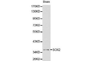 Western Blotting (WB) image for anti-SRY (Sex Determining Region Y)-Box 2 (SOX2) (AA 1-140) antibody (ABIN6213889) (SOX2 anticorps  (AA 1-140))