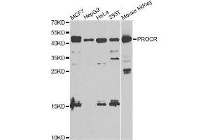 Western blot analysis of extracts of various cell lines, using PROCR antibody (ABIN5973385) at 1/1000 dilution. (PROCR anticorps)