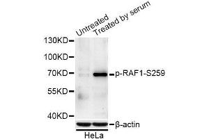 Western blot analysis of extracts of NIH/3T3 and HeLa cells, using Phospho-RAF1-S259 antibody (ABIN5996185) at 1/1000 dilution. (RAF1 anticorps  (pSer259))