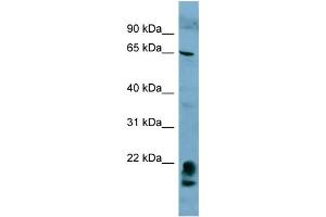 WB Suggested Anti-FAM134A  Antibody Titration: 0. (FAM134A anticorps  (N-Term))