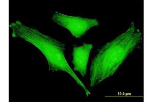 Immunofluorescence of monoclonal antibody to SLC2A4RG on HeLa cell. (SLC2A4RG anticorps  (AA 178-269))