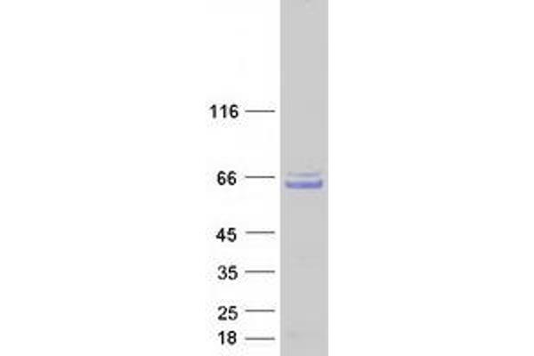 CCDC130 Protein (Myc-DYKDDDDK Tag)