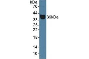 Western blot analysis of Rat Serum. (Haptoglobin anticorps  (AA 70-332))