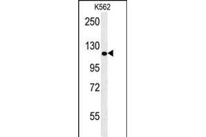 POTEE Antibody (Center) (ABIN653968 and ABIN2843918) western blot analysis in K562 cell line lysates (35 μg/lane). (POTEE anticorps  (AA 380-409))