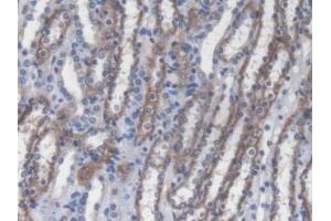 DAB staining on IHC-P; Samples: Mouse Kidney Tissue (RIPK2 anticorps  (AA 1-294))