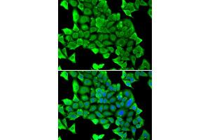 Immunofluorescence analysis of U20S cell using MYH1 antibody. (MYH1 anticorps)