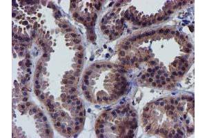 Immunohistochemistry (IHC) image for anti-Coiled-Coil-Helix-Coiled-Coil-Helix Domain Containing 5 (CHCHD5) (AA 1-110) antibody (ABIN1490561) (CHCHD5 anticorps  (AA 1-110))