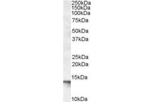 Western Blotting (WB) image for anti-C1D Nuclear Receptor Corepressor (C1D) (C-Term) antibody (ABIN2466619) (C1D anticorps  (C-Term))