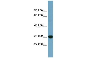 WB Suggested Anti-HMGB2 Antibody Titration: 0. (HMGB2 anticorps  (Middle Region))