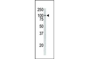 Western Blotting (WB) image for anti-TPX2, Microtubule-Associated, Homolog (Xenopus Laevis) (TPX2) antibody (ABIN356359) (TPX2 anticorps)