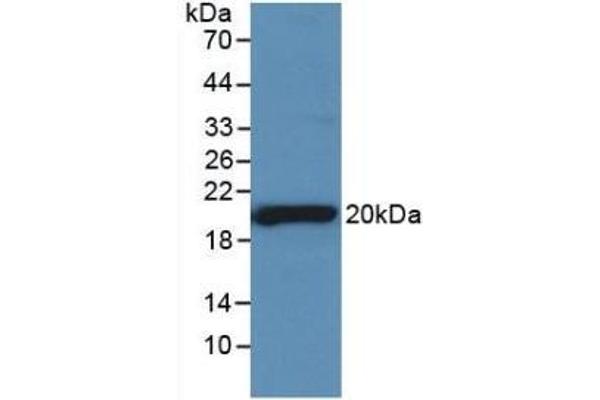SHBG anticorps  (AA 222-358)