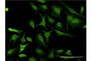 Immunofluorescence of monoclonal antibody to RING1 on HeLa cell. (RING1 anticorps  (AA 81-170))