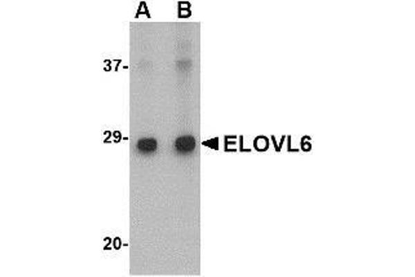 ELOVL6 anticorps  (N-Term)