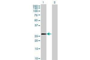 Lane 1: ZNF771 transfected lysate ( 30. (ZNF771 293T Cell Transient Overexpression Lysate(Denatured))