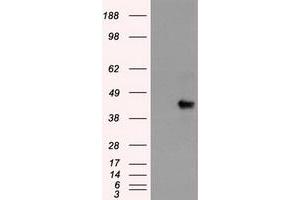 HEK293T cells were transfected with the pCMV6-ENTRY control (Left lane) or pCMV6-ENTRY SOX17 (Right lane) cDNA for 48 hrs and lysed. (SOX17 anticorps  (AA 177-414))