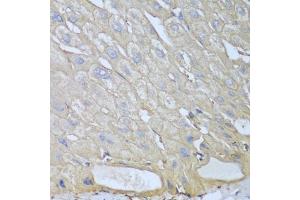 Immunohistochemistry of paraffin-embedded human liver using RPH3AL antibody (ABIN5974449) at dilution of 1/100 (40x lens). (RPH3AL anticorps)