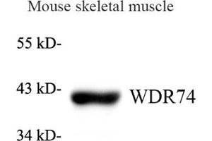 Western blot analysis of WDR74 (ABIN7076220) at dilution of 1: 1000 (WDR74 anticorps)